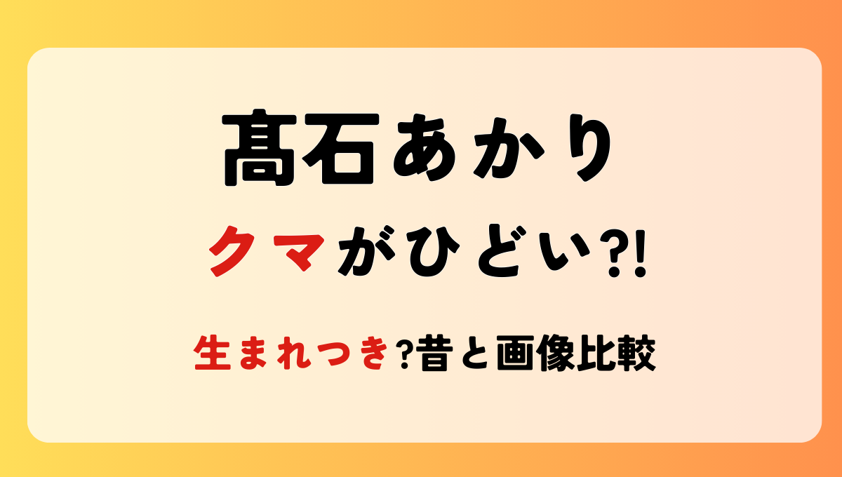 【高石あかり】目の下のクマが酷い?!理由4つ!生まれつき?昔と画像検証！